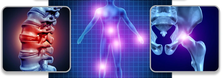 Graphic showing bones and the human body in blue tones with some reddish hues